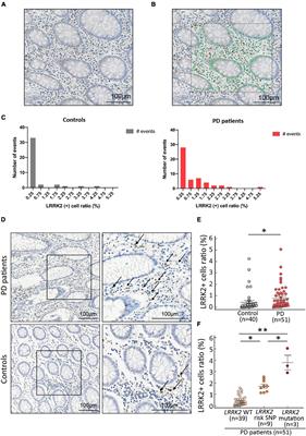 Colonic Leucine-Rich Repeat Kinase 2 Expression Is Increased and Associated With Disease Severity in Patients With Parkinson’s Disease